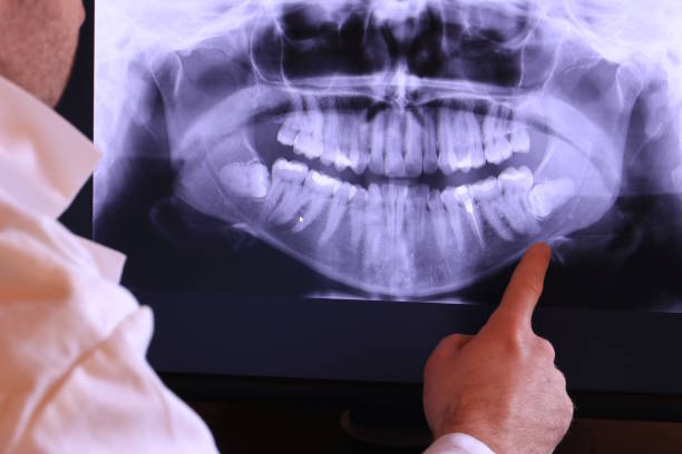 Best Emergency Tooth Extraction in Enterprise, OR